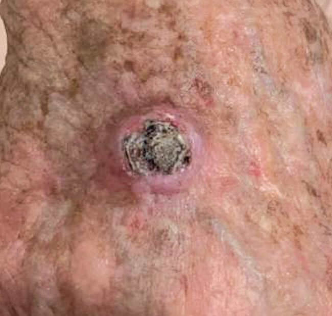 Pasted image 20230725054622.png|400