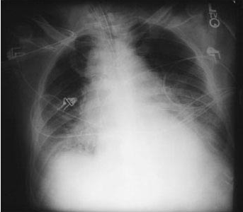 Pasted image 20230802080205.png