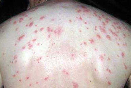 Pasted image 20230802222808.png