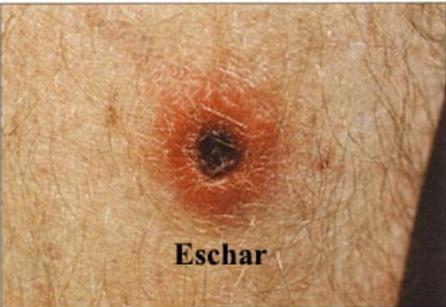 Pasted image 20230802225747.png|350