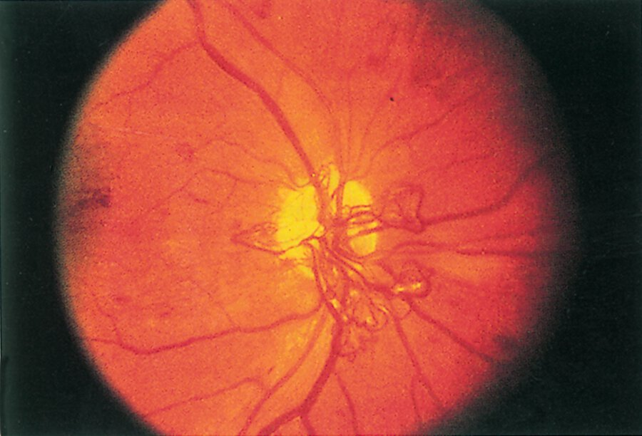 Pasted image 20230811081920.png|500