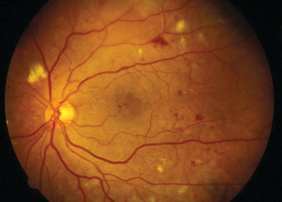 Pasted image 20230811081935.png|500