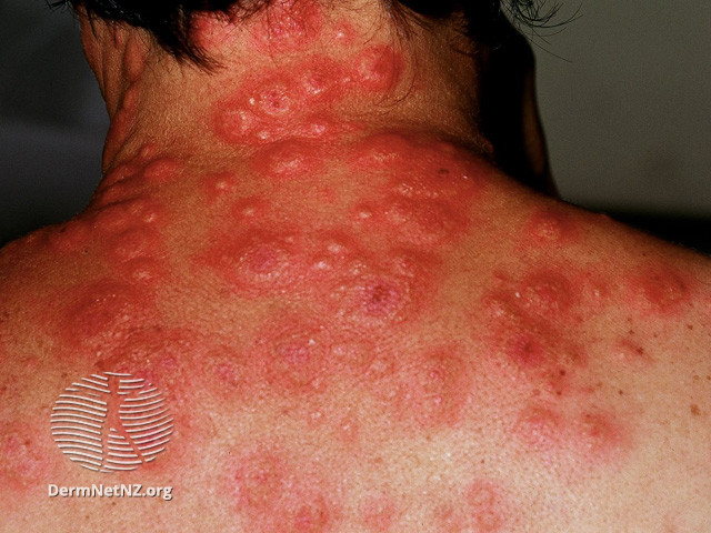 sweet08__WatermarkedWyJXYXRlcm1hcmtlZCJd.jpg|400